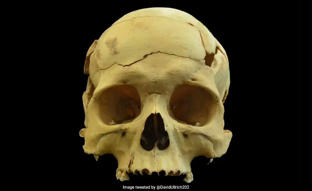 Skull Found In China Shows Complex Brain Surgery Performed 2,700 Years Ago