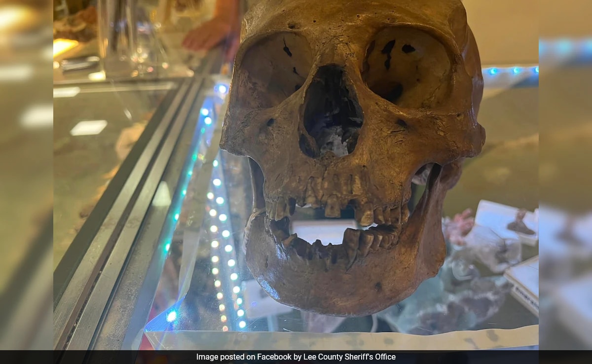 Anthropologist Discovers Real Human Skull In US Antique Store