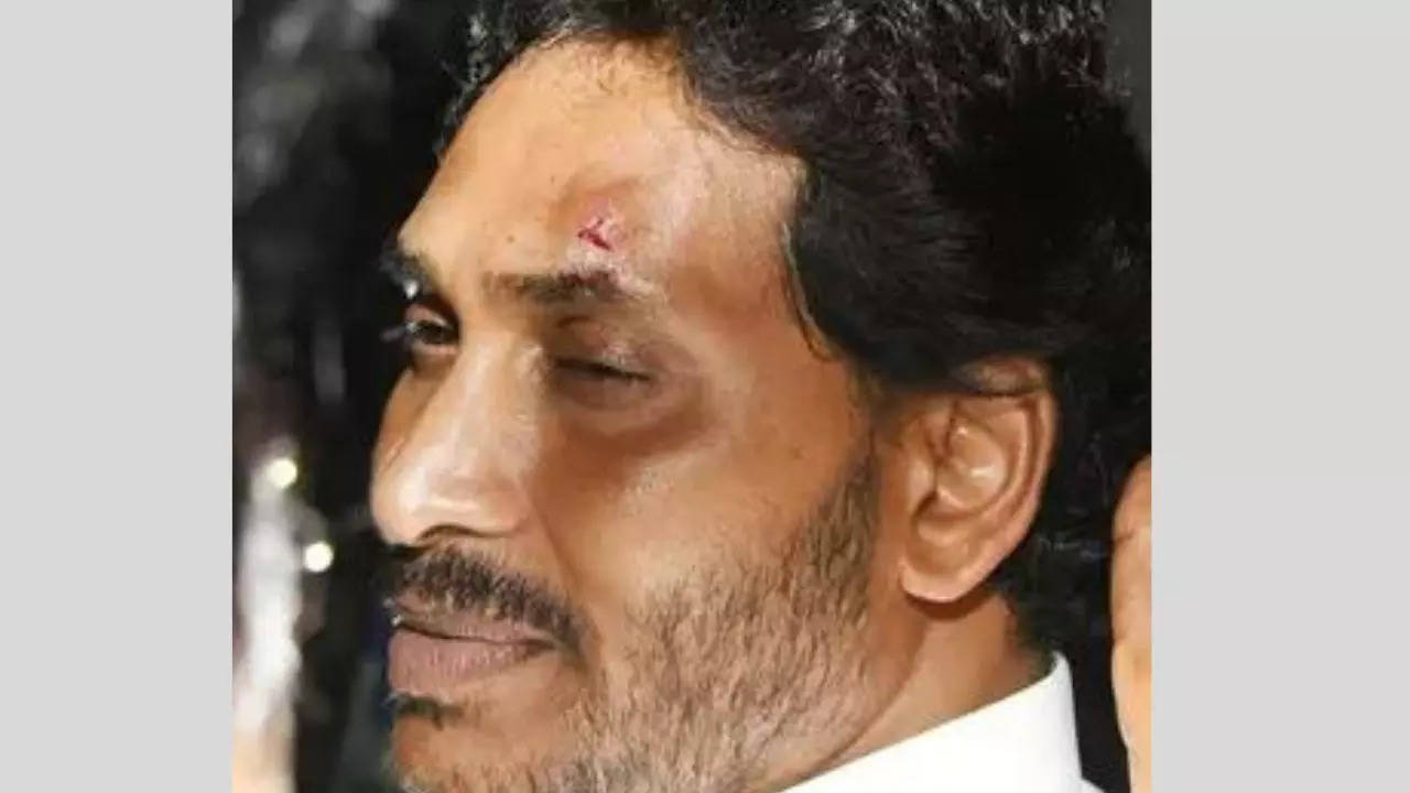 Andhra CM Jagan Reddy hurt in stone pelting in Vijayawada
