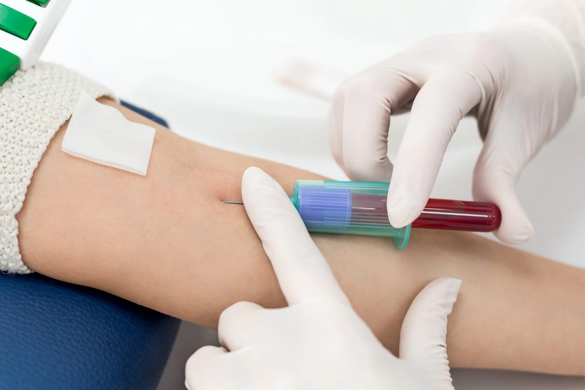 Problems with Eyes, Skin, Nervous System, Or Period Issues: New Study Found Covaxin Side Effects after 1-year Follow-up Problems with Eyes, Skin, Nervous System, Or Period Issues: New Study Found Covaxin Side Effects after 1-year Follow-up