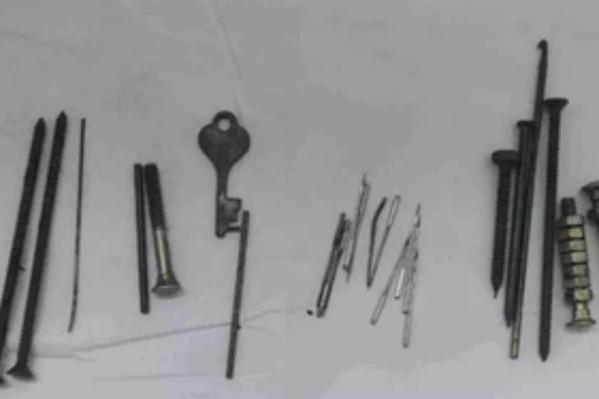 Jaipur: Nails, Needles, Nuts, And Bolts Removed From Man’s Stomach During Surgery