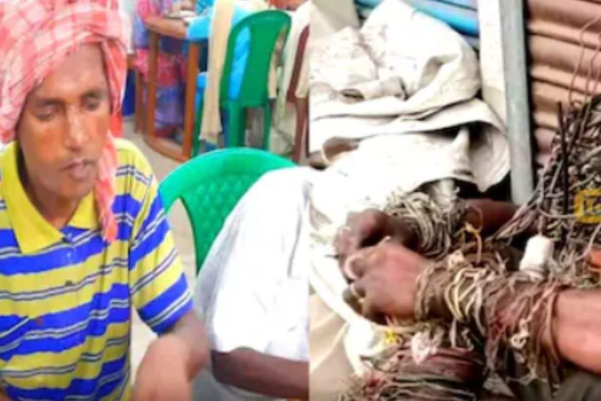 In West Bengal’s North 24 Parganas, Locals Rescue ‘Iron Man’ After Years Of Struggle