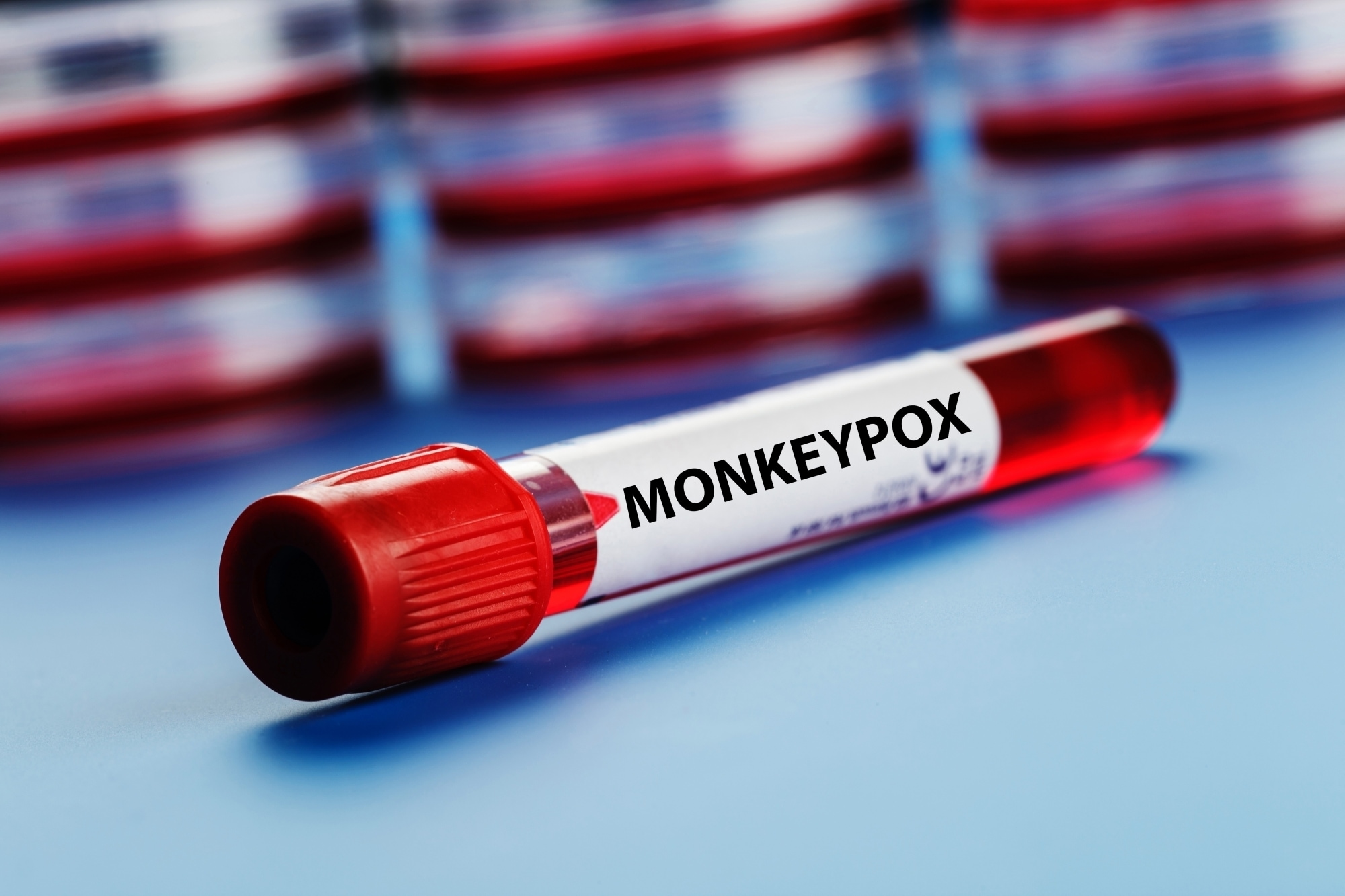 Indian Airports, Borders On Alert As Global Mpox Cases Rise: 10 Points