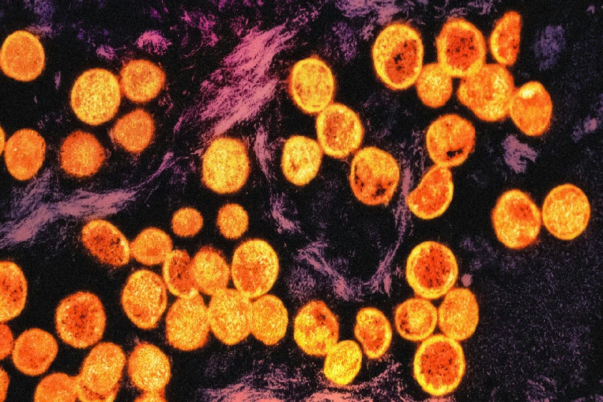 India Now 3rd non-African Nation with ‘Complicated’ Mpox Strain; Centre Asks States, UTs to Boost Efforts