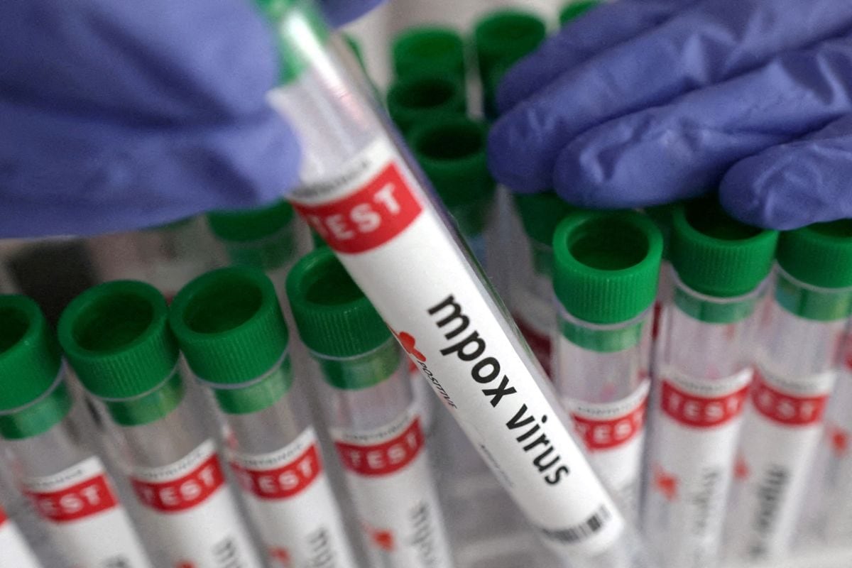 Kerala Confirms Second Mpox Case, UAE Returnee Admitted To Kochi Hospital