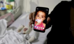Father describes moment Israeli missile leaves toddler with third-degree burns