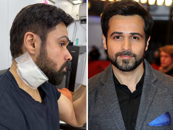 Emraan Hashmi gets injured on sets of Goodachari 2