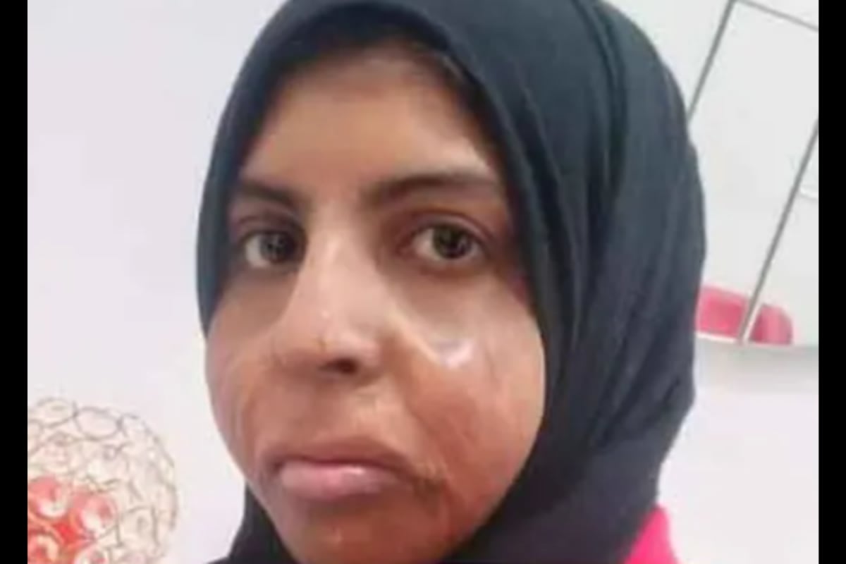 ‘Indian Embassy Continues To Follow Up On Shahzadi’s Case’: Sources