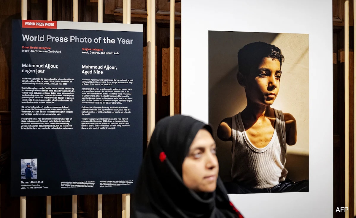 Portrait Of Palestinian Boy Who Lost Both Arms In Israeli Attack Wins World Press Photo Award