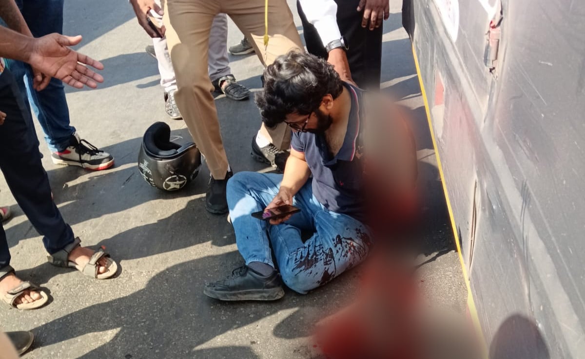 Mumbai Man’s Hand Severed After His Bike Collides With Bus