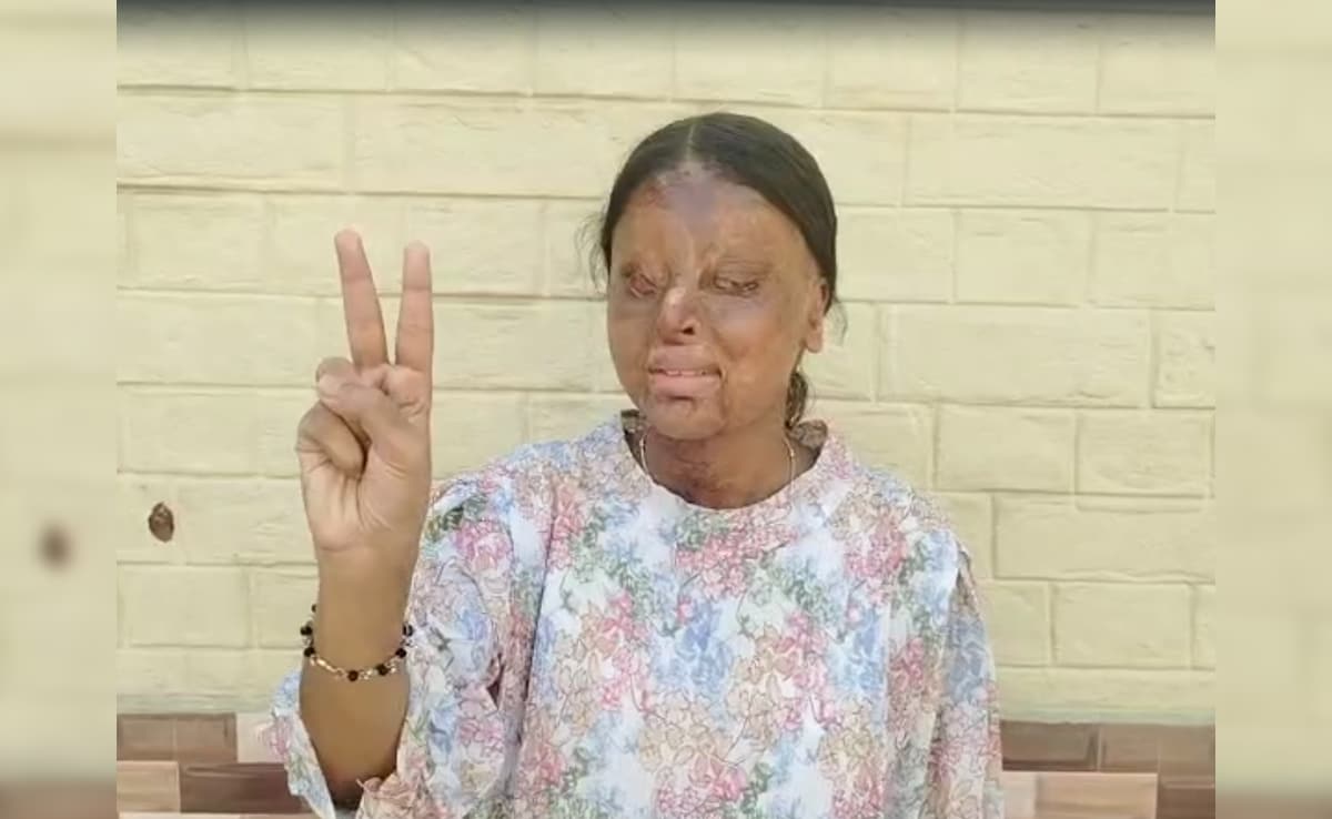 Chandigarh Teen Lost Eyes In Acid Attack, Scores 95.6% In Class 12 Boards