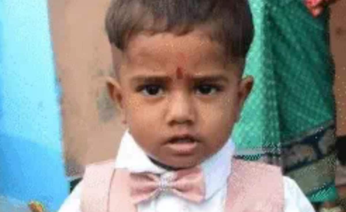 UP Man Throws Axe At Monkeys, It Slashes His Two-Year-Old Son’s Neck