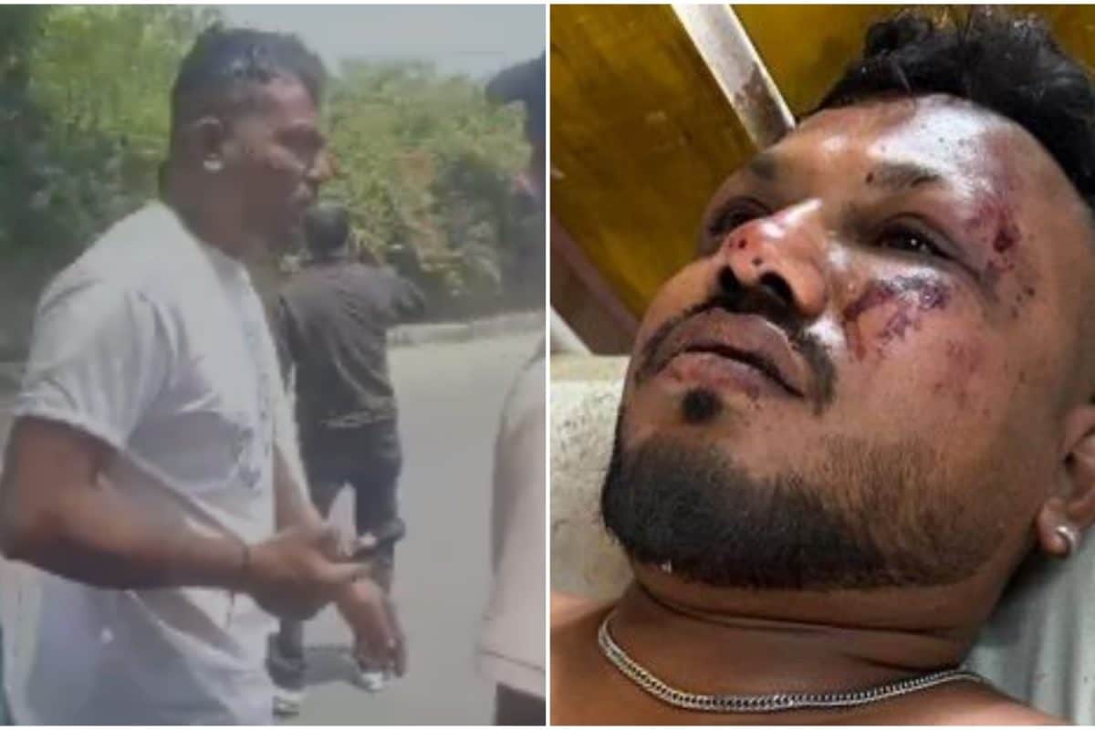 ‘A Miracle In Tragedy’: Sole Survivor Of Air India Crash Leaves Internet Stunned