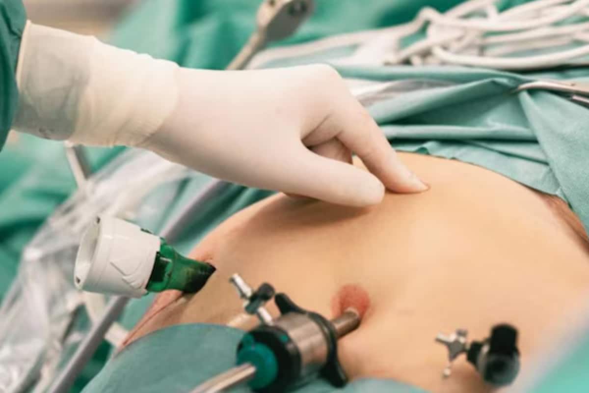 Surgical Cloth Found In Ghaziabad Woman’s Stomach Days After C-Section