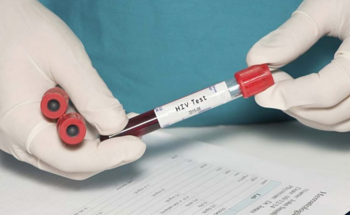 If US Funding For HIV Programs Is Not Replaced, Millions More Will Die: UN