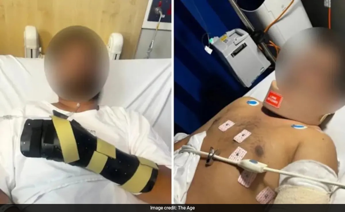 Indian-Origin Man Attacked With Machete In Australia, 4 Teens Arrested
