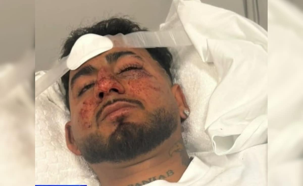 “F*** Off, Indian”: Man Brutally Assaulted, Racially Abused In Australia