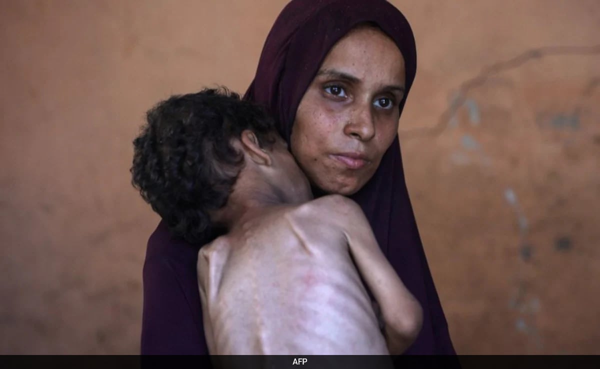 “Body Sacrifices Own Tissue”: Gaza Doctor On The Impact Of Starvation