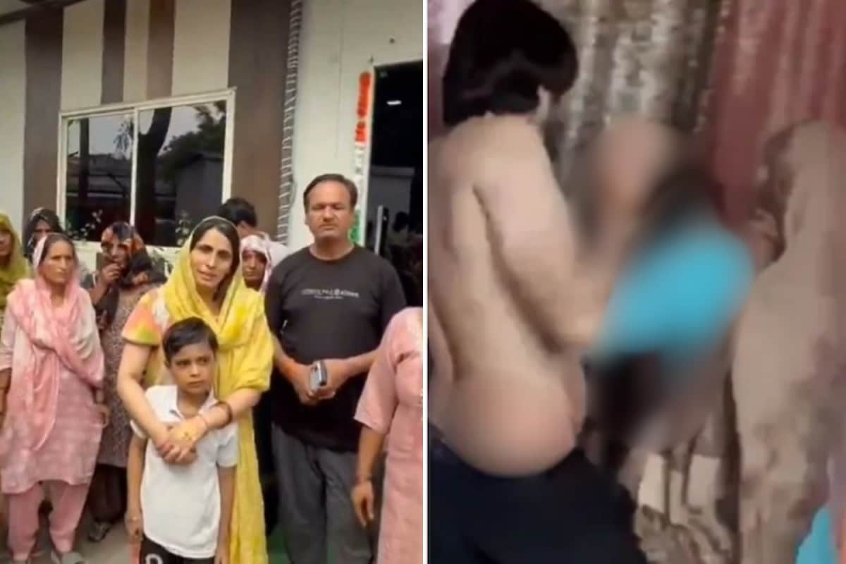 ‘They Slapped Mumma, Then Set Her On Fire’: Noida Boy Describes Mother’s Dowry Death