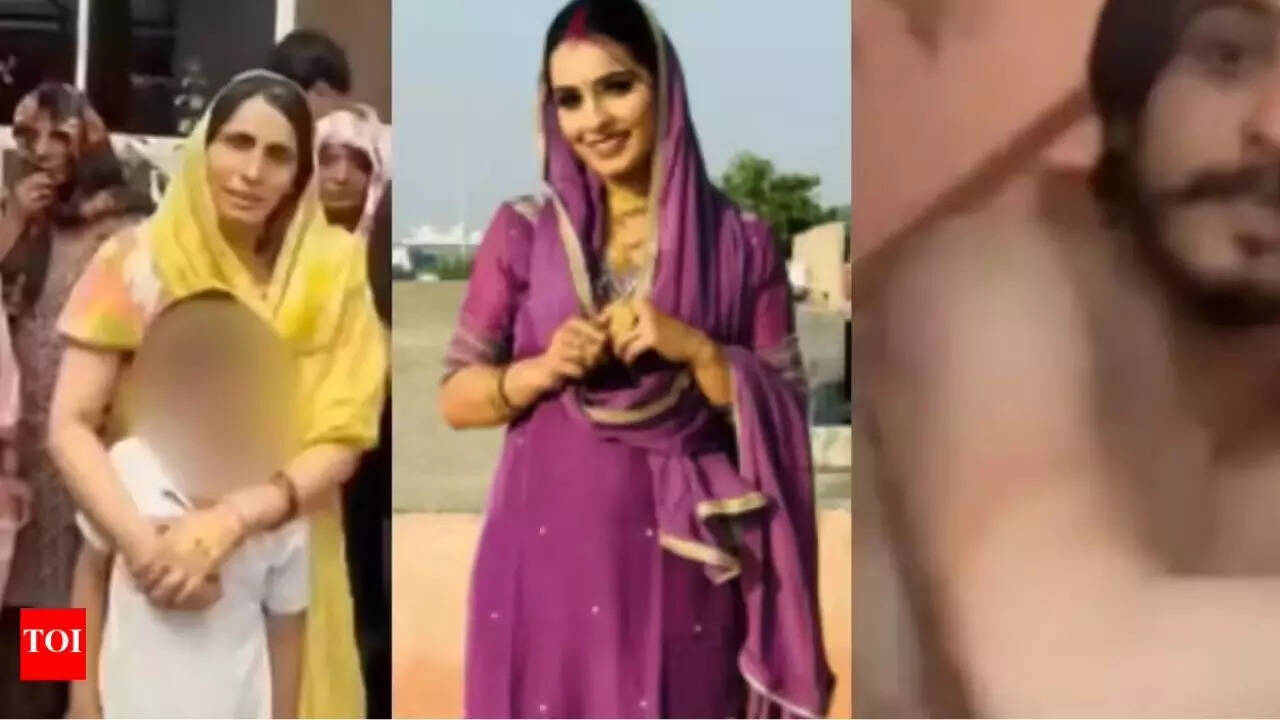 Big twist in Noida case: Nikki Bhati told doctors her burns were from cylinder blast