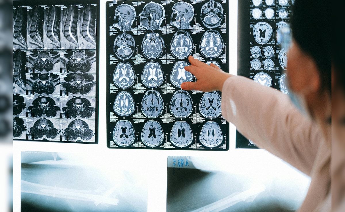 ‘Brain-Eating Amoeba’ Kills 19 In Kerala. How It Spreads, How To Stay Safe