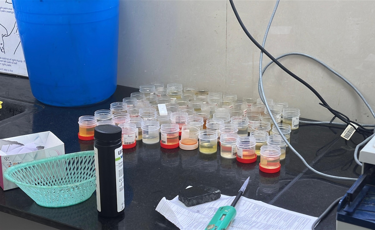 NDTV Exclusive: Madhya Pradesh Government Labs Under Scanner Over “Wrong” Test Reports