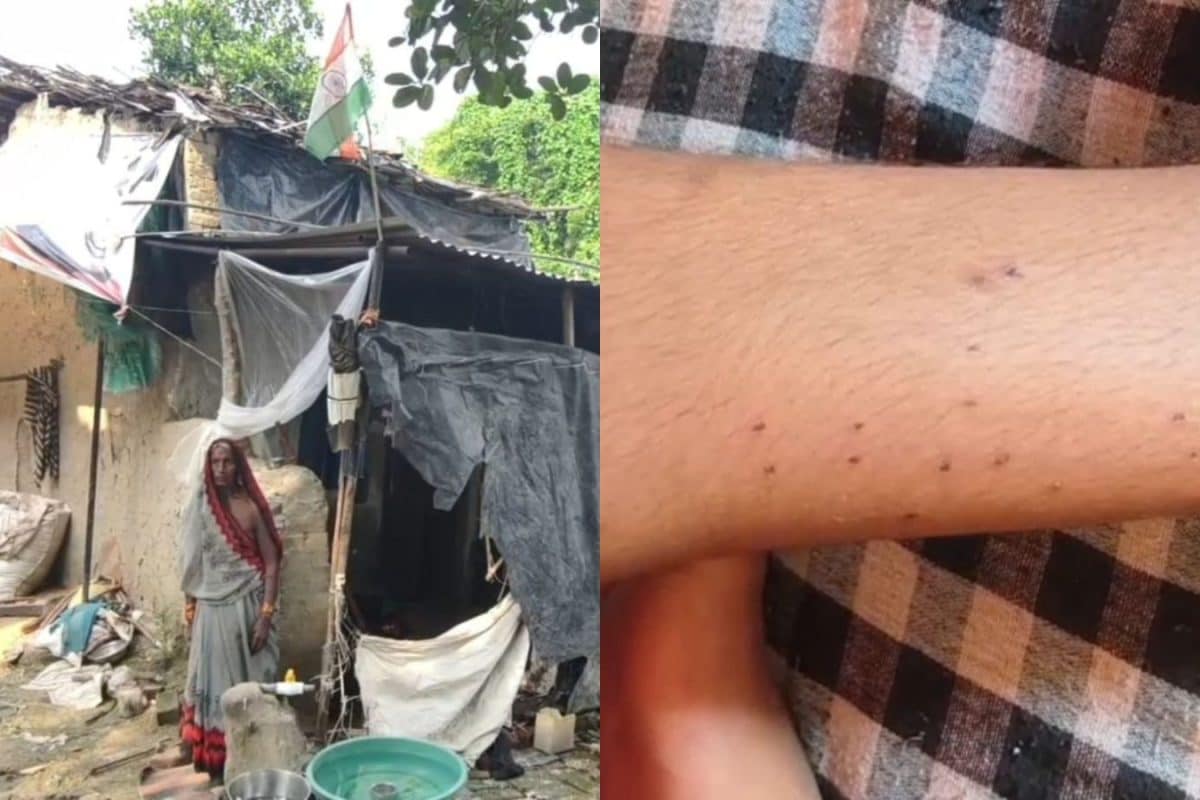 ‘After My Life’: Teenager From UP Village Says ‘Same Black Snake’ Bit Her ’13 Times In 40 Days’