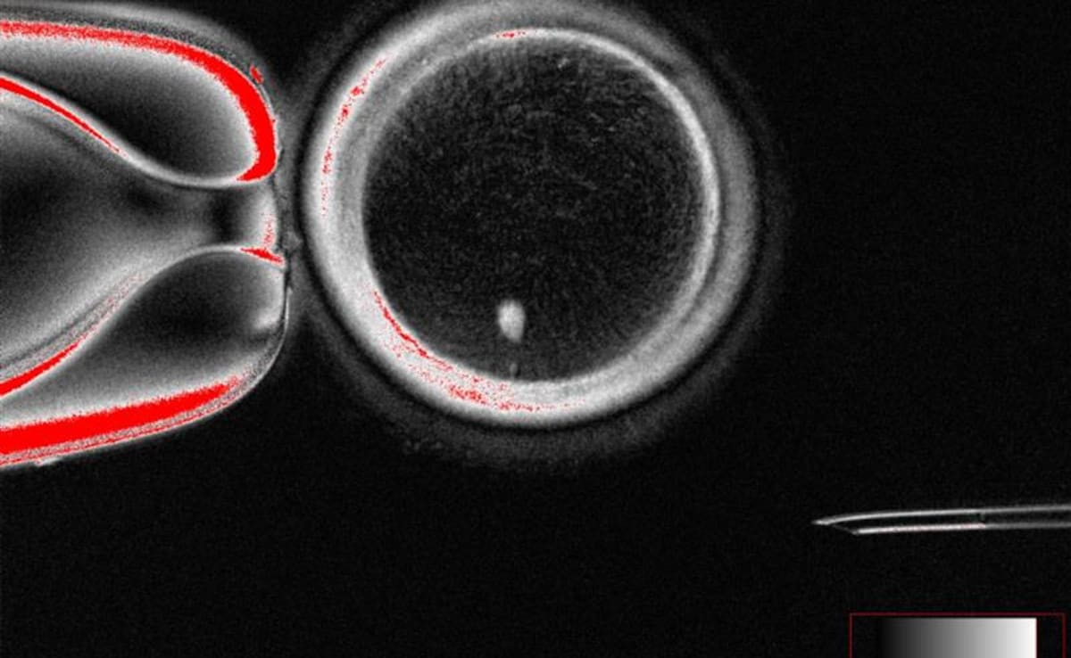 Human Skin Cells Turned Into Fertilisable Eggs For First Time