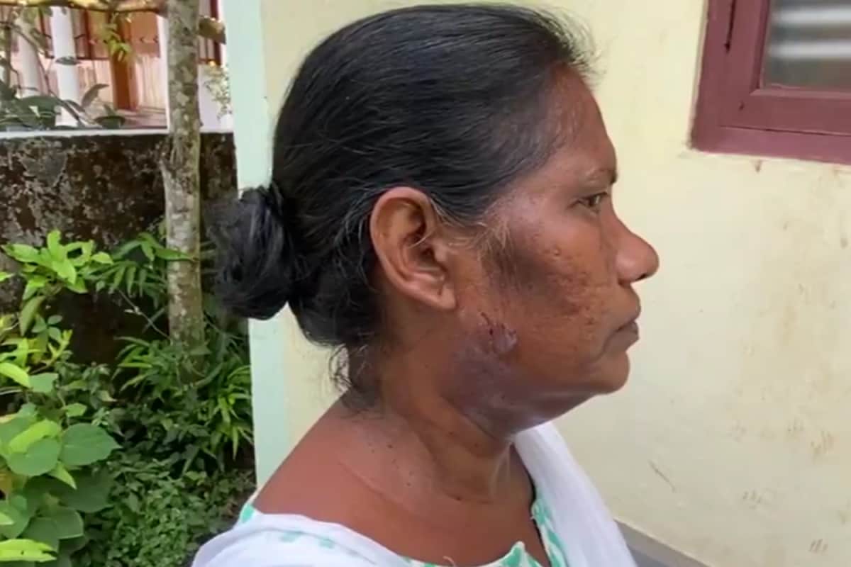 Kerala Poll Officer Attacked By Pet Dog During Voter List Revision Visit